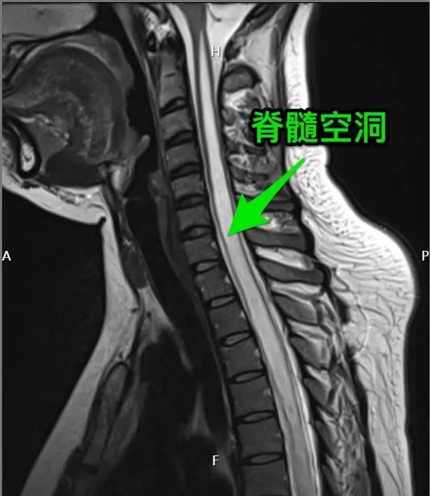 "膜"界奇谈：笑谈颈腰间的科技风云