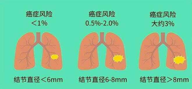 "科技界的新宠儿：男配体内结节记"