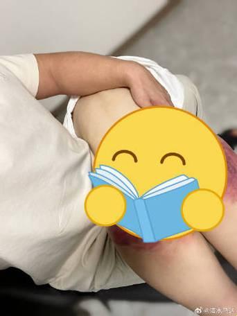 微博挨揍三天惩罚期？别慌！这份急救指南能救你的赛博人格