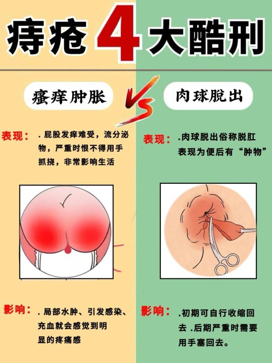 惊爆！网友深挖“肛门刑罚有多疼”背后藏着什么秘密？