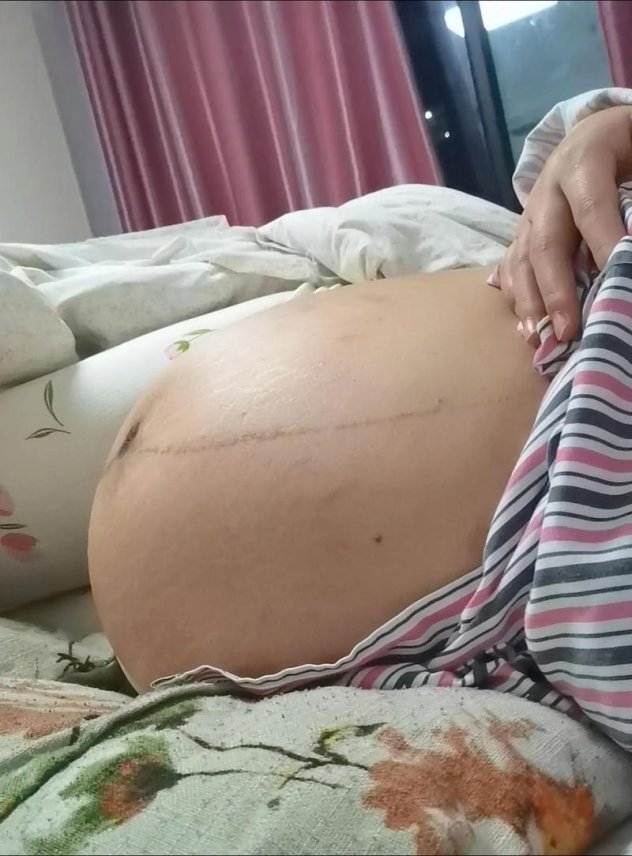 将军肚腹挺起生孩子难产，千年之痛为何仍在延续？