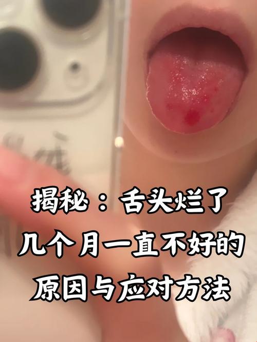 2025年口腔江湖新难题:舌头探洞太深怎么办?这些黑科技操作让网友直呼真香!