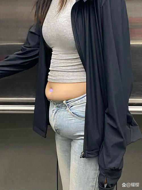 2025新争议：别塞珠子了肚子鼓起来竟成全民健康警报？新手必看避坑指南