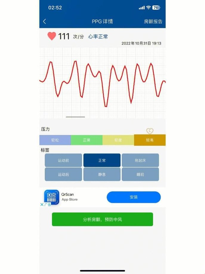 2025年智能健康管理痛点下的心跳app官方网站深度解析